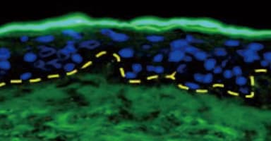 BMTS-Clostridium Botulinum