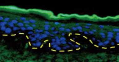 Clostridium Botulinum